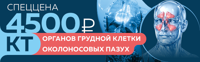 20260302_4500 КТ органов грудной клетки и околоносовых пазух_v01.jpg